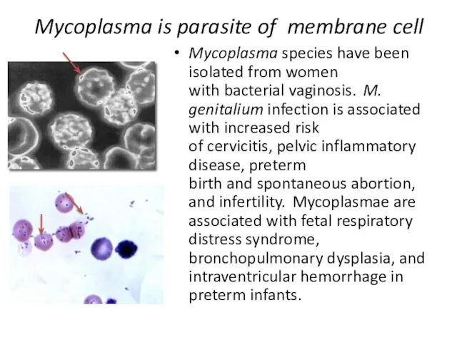 Mycoplasma is parasite of membrane cell Mycoplasma species have been isolated from women