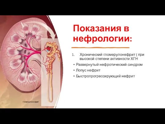 Показания в нефрологии: Хронический гломерулонефрит ( при высокой степени активности
