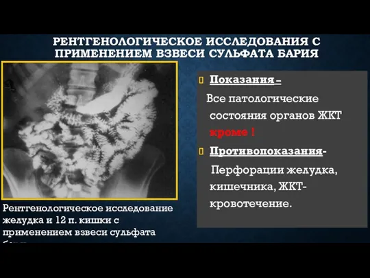 РЕНТГЕНОЛОГИЧЕСКОЕ ИССЛЕДОВАНИЯ С ПРИМЕНЕНИЕМ ВЗВЕСИ СУЛЬФАТА БАРИЯ Показания – Все