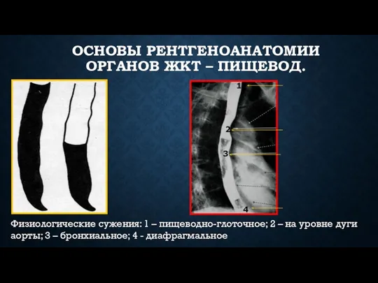 ОСНОВЫ РЕНТГЕНОАНАТОМИИ ОРГАНОВ ЖКТ – ПИЩЕВОД. 2 3 1 4