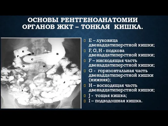 ОСНОВЫ РЕНТГЕНОАНАТОМИИ ОРГАНОВ ЖКТ – ТОНКАЯ КИШКА. Е – луковица