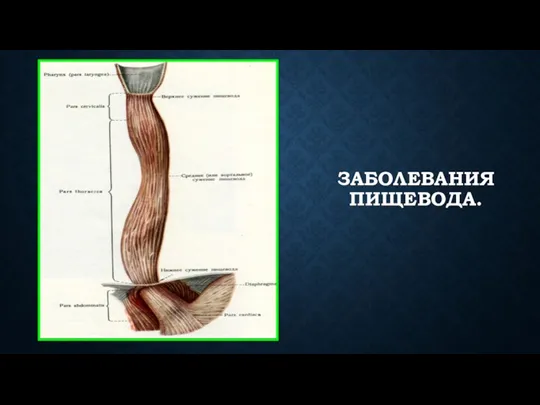 ЗАБОЛЕВАНИЯ ПИЩЕВОДА.