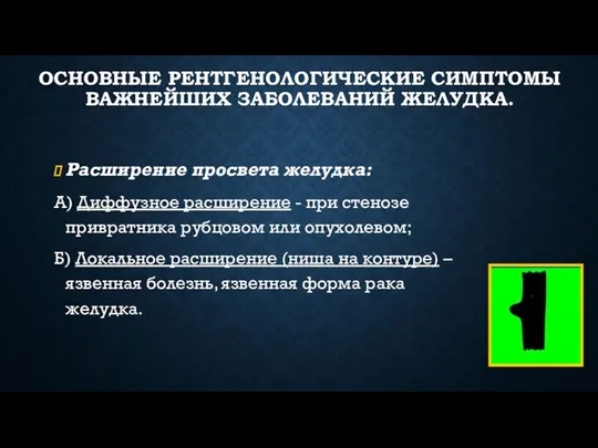 ОСНОВНЫЕ РЕНТГЕНОЛОГИЧЕСКИЕ СИМПТОМЫ ВАЖНЕЙШИХ ЗАБОЛЕВАНИЙ ЖЕЛУДКА. Расширение просвета желудка: А)