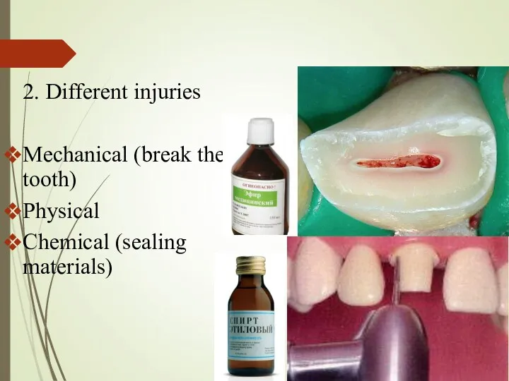 2. Different injuries Mechanical (break the tooth) Physical Chemical (sealing materials)