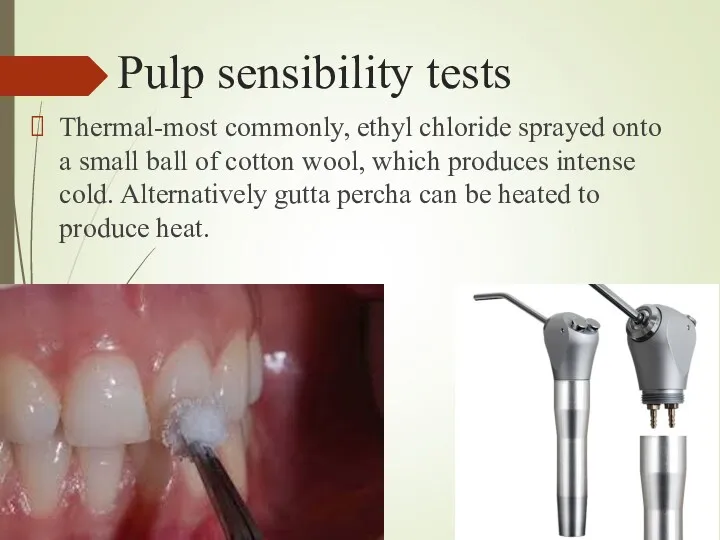 Pulp sensibility tests Thermal-most commonly, ethyl chloride sprayed onto a