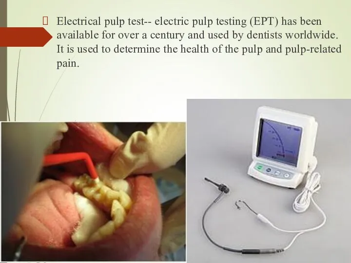Electrical pulp test-- electric pulp testing (EPT) has been available