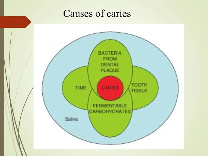 Causes of caries