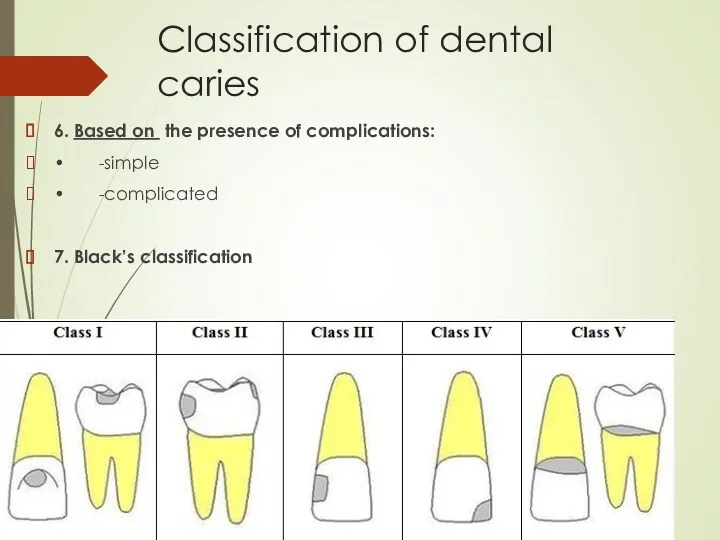 Classification of dental caries 6. Based on the presence of