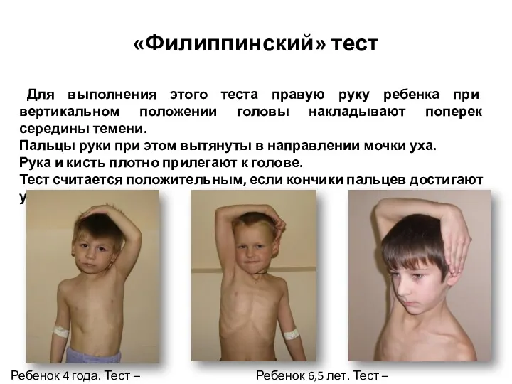 Для выполнения этого теста правую руку ребенка при вертикальном положении головы накладывают поперек