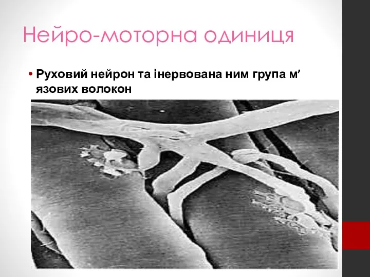 Нейро-моторна одиниця Руховий нейрон та інервована ним група м’язових волокон