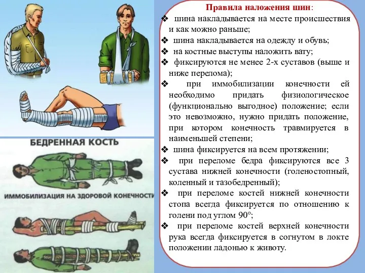 Правила наложения шин: шина накладывается на месте происшествия и как