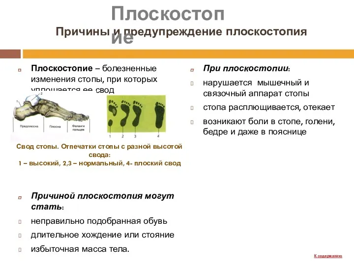 Причины и предупреждение плоскостопия Плоскостопие – болезненные изменения стопы, при