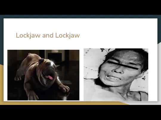 Lockjaw and Lockjaw