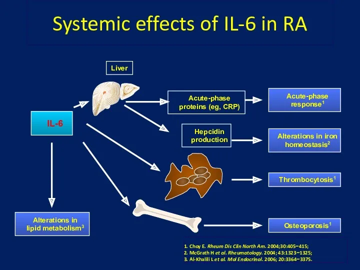 Systemic effects of IL-6 in RA IL-6 Acute-phase response1 Alterations