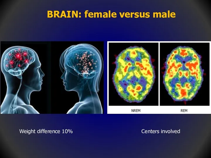 BRAIN: female versus male Weight difference 10% Centers involved