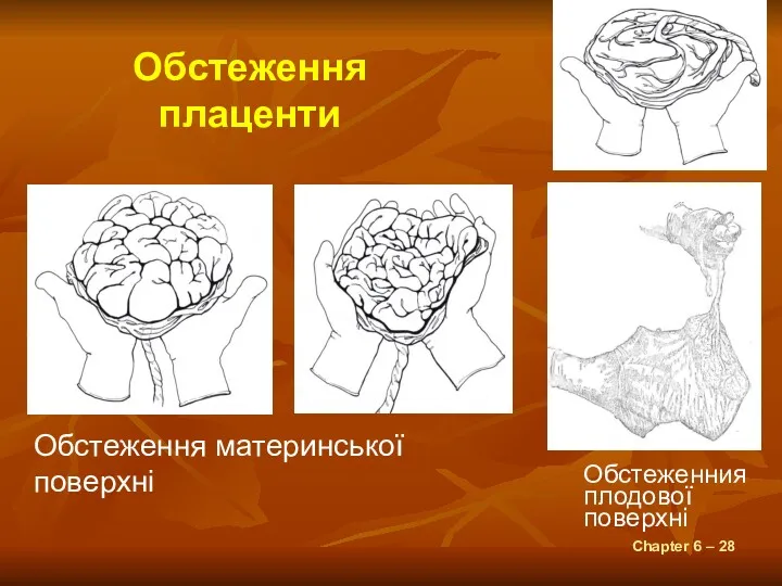 Chapter 6 – Обстеження плаценти Обстеження материнської поверхні Обстеженния плодової поверхні