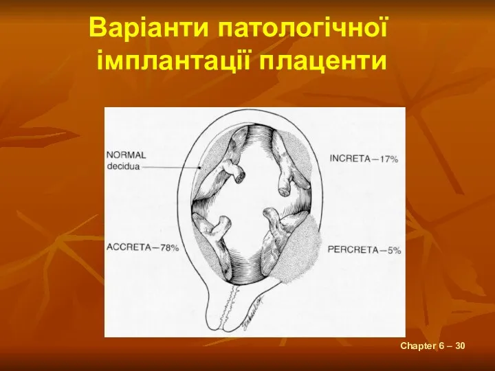 Chapter 6 – Варіанти патологічної імплантації плаценти