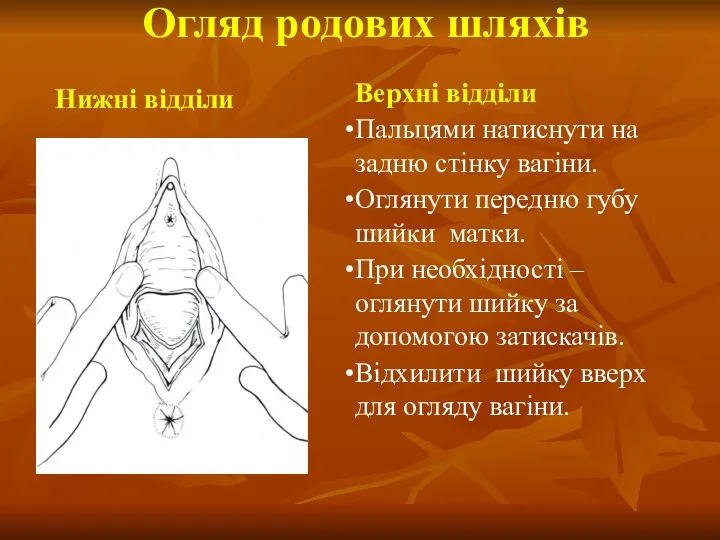 Огляд родових шляхів Верхні відділи Пальцями натиснути на задню стінку