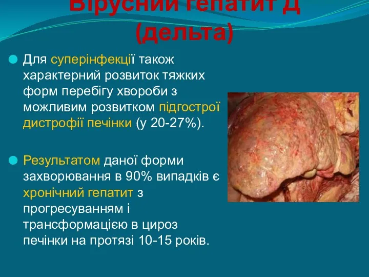 Вірусний гепатит Д (дельта) Для суперінфекції також характерний розвиток тяжких