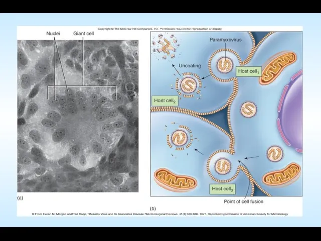 Insert figure 25.5 Effects of paramyxoviruses