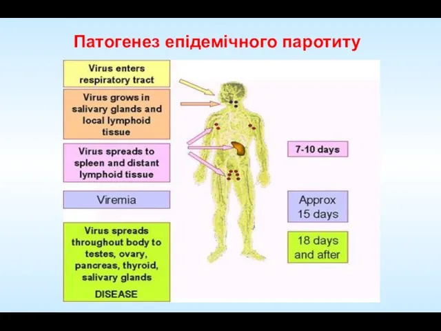 Патогенез епідемічного паротиту