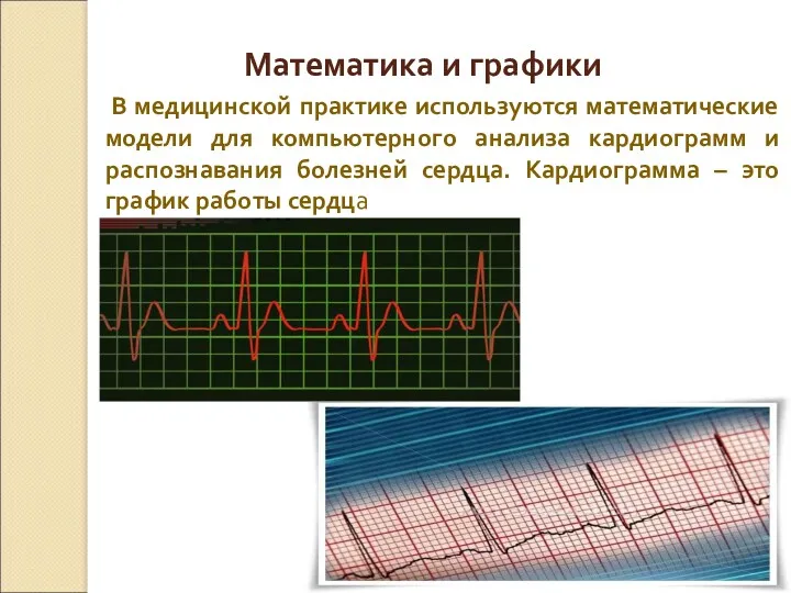 В медицинской практике используются математические модели для компьютерного анализа кардиограмм