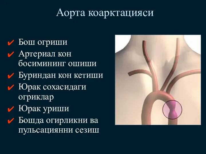 Аорта коарктацияси Бош огриши Артериал кон босимининг ошиши Буриндан кон