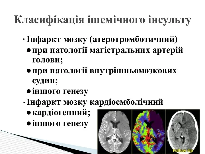 Класифікація ішемічного інсульту Інфаркт мозку (атеротромботичний) при патології магістральних артерій