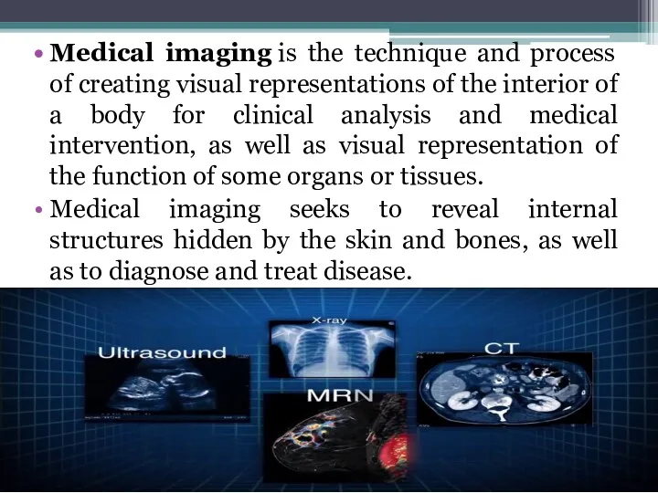 Medical imaging is the technique and process of creating visual