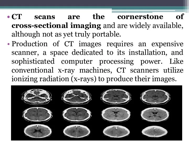 CT scans are the cornerstone of cross-sectional imaging and are
