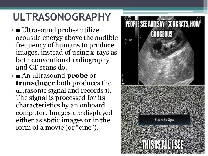 ULTRASONOGRAPHY ■ Ultrasound probes utilize acoustic energy above the audible