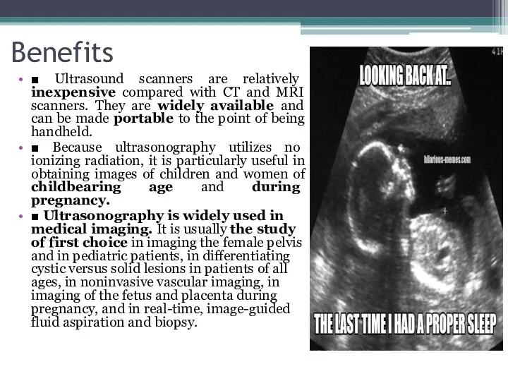 Benefits ■ Ultrasound scanners are relatively inexpensive compared with CT