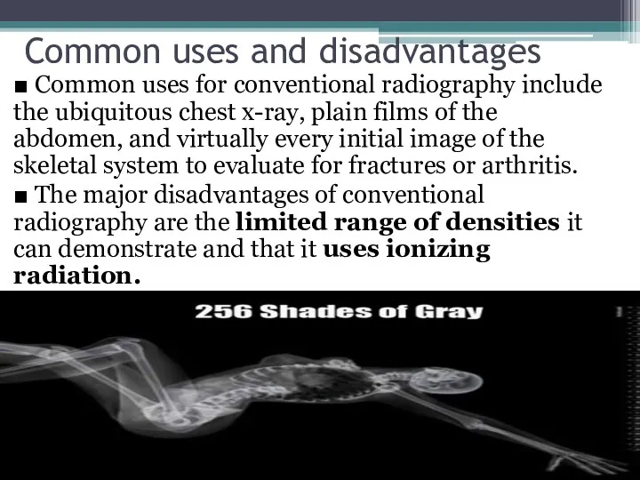 Common uses and disadvantages ■ Common uses for conventional radiography