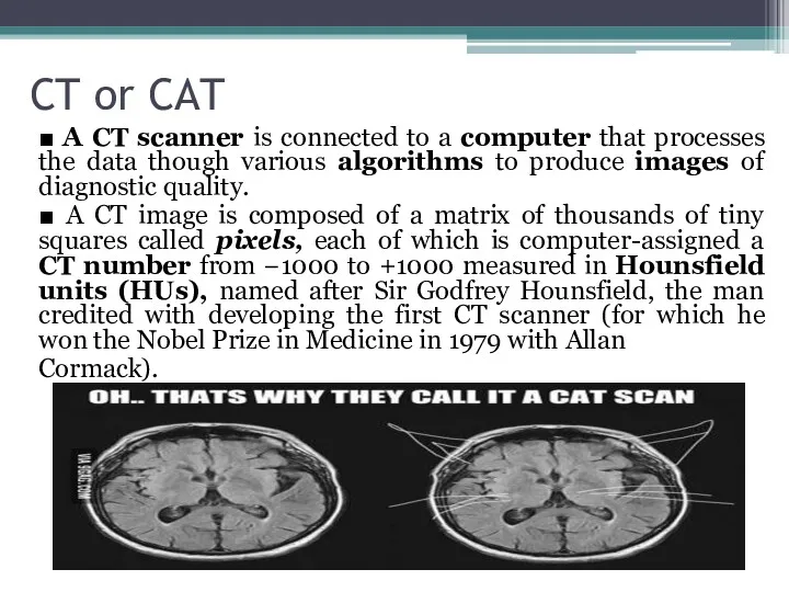 CT or CAT ■ A CT scanner is connected to