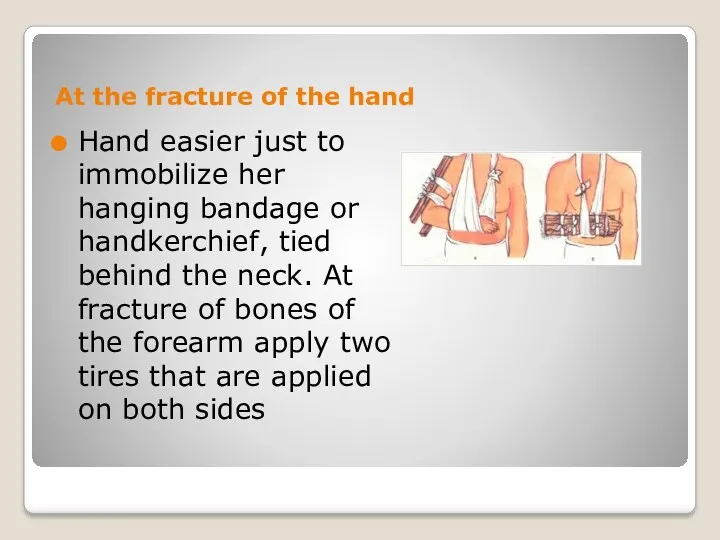 At the fracture of the hand Hand easier just to
