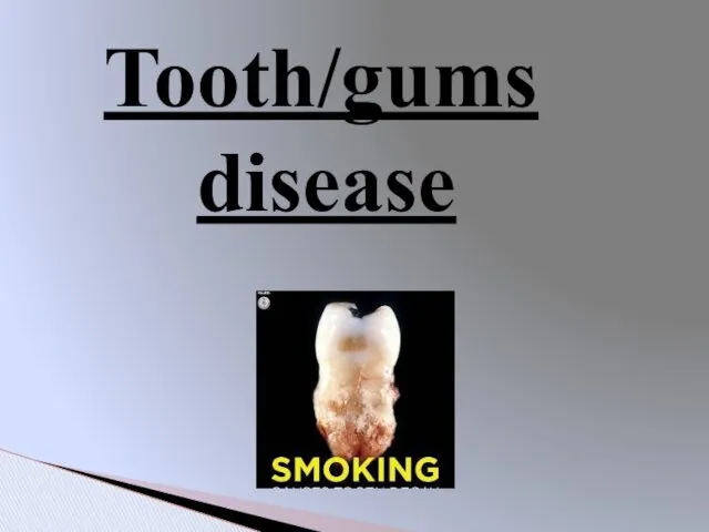Tooth/gums disease
