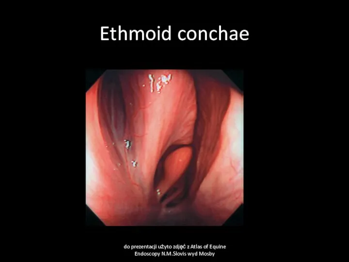 Ethmoid conchae do prezentacji użyto zdjęć z Atlas of Equine Endoscopy N.M.Slovis wyd Mosby