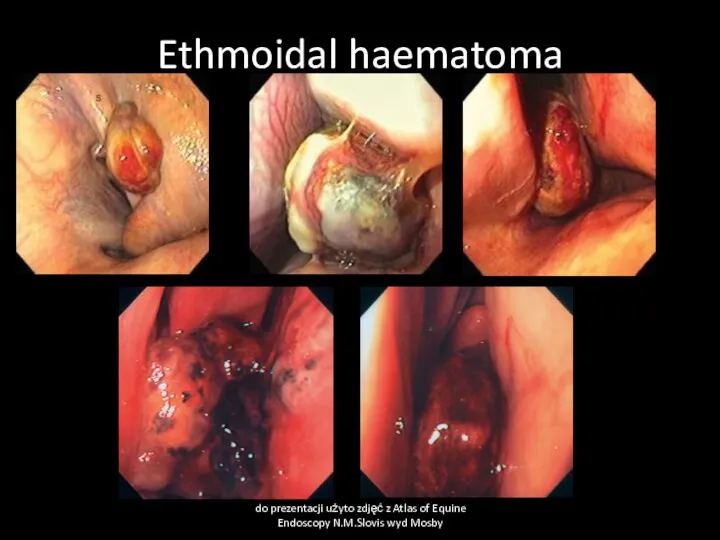 Ethmoidal haematoma do prezentacji użyto zdjęć z Atlas of Equine Endoscopy N.M.Slovis wyd Mosby