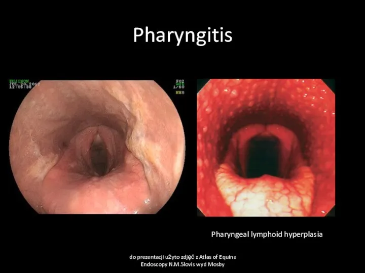 Pharyngitis do prezentacji użyto zdjęć z Atlas of Equine Endoscopy N.M.Slovis wyd Mosby Pharyngeal lymphoid hyperplasia