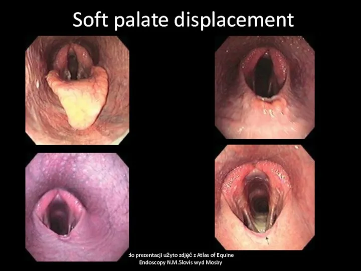 Soft palate displacement do prezentacji użyto zdjęć z Atlas of Equine Endoscopy N.M.Slovis wyd Mosby