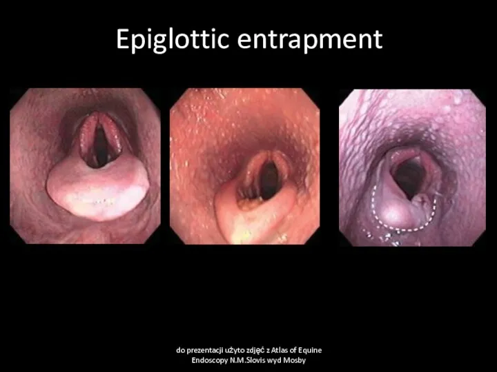 Epiglottic entrapment do prezentacji użyto zdjęć z Atlas of Equine Endoscopy N.M.Slovis wyd Mosby