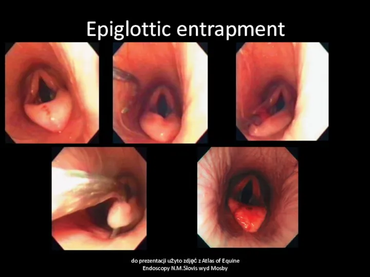 Epiglottic entrapment do prezentacji użyto zdjęć z Atlas of Equine Endoscopy N.M.Slovis wyd Mosby