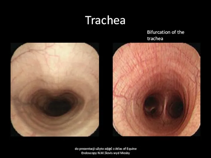 Trachea do prezentacji użyto zdjęć z Atlas of Equine Endoscopy