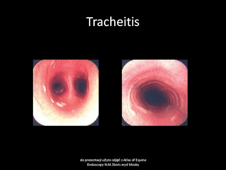 Tracheitis do prezentacji użyto zdjęć z Atlas of Equine Endoscopy N.M.Slovis wyd Mosby