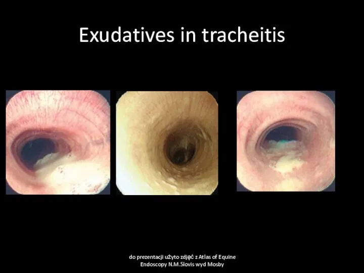 Exudatives in tracheitis do prezentacji użyto zdjęć z Atlas of Equine Endoscopy N.M.Slovis wyd Mosby