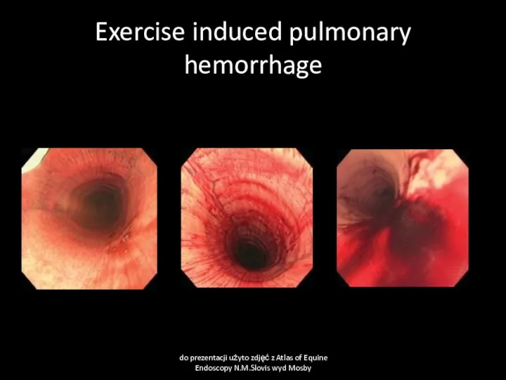 Exercise induced pulmonary hemorrhage do prezentacji użyto zdjęć z Atlas of Equine Endoscopy N.M.Slovis wyd Mosby