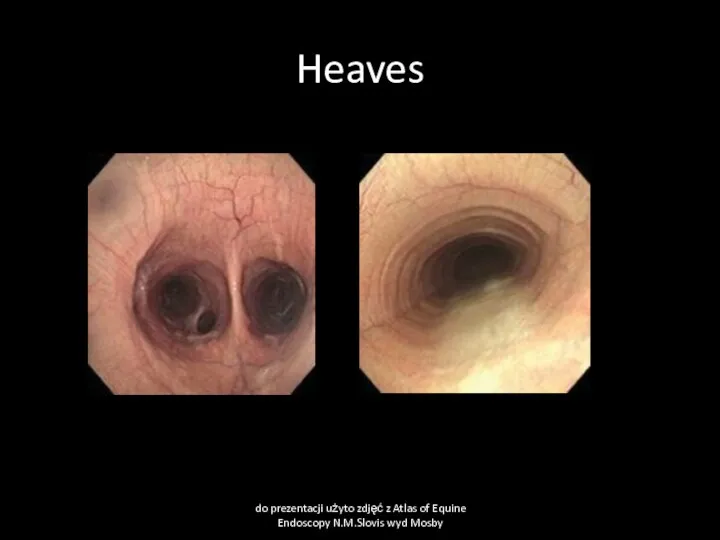Heaves do prezentacji użyto zdjęć z Atlas of Equine Endoscopy N.M.Slovis wyd Mosby
