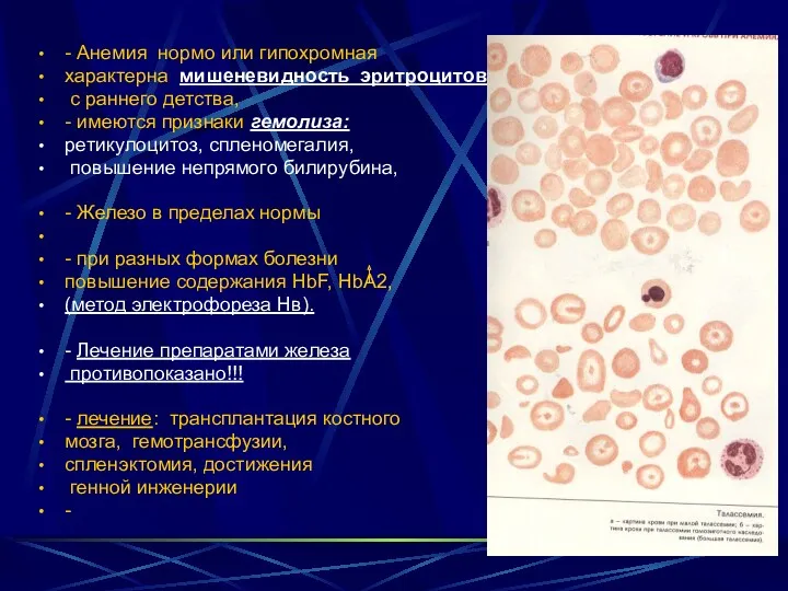 - Анемия нормо или гипохромная характерна мишеневидность эритроцитов с раннего