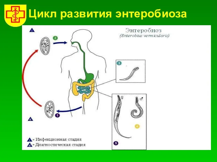 Цикл развития энтеробиоза
