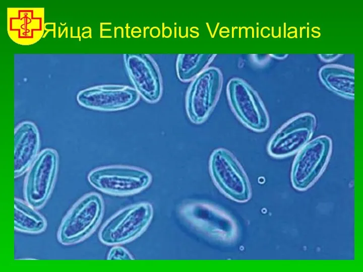 Яйца Enterobius Vermicularis